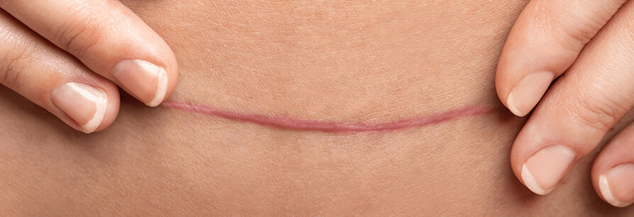 Image without a name 